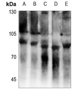 EMR2 Rabbit Polyclonal Antibody