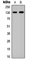 EPHA2 Rabbit Polyclonal Antibody