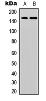 HER3 (Phospho-Y1328) Rabbit Polyclonal Antibody