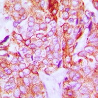 HER3 (Phospho-Y1328) Rabbit Polyclonal Antibody