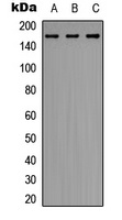 ERCC6 Rabbit Polyclonal Antibody