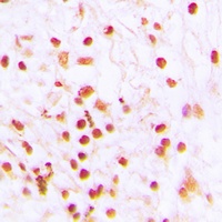 ERCC6 Rabbit Polyclonal Antibody