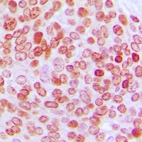 PE2 Rabbit Polyclonal Antibody