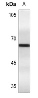 Estrogen Receptor alpha (Phospho-S106) Rabbit Polyclonal Antibody