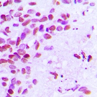 Estrogen Receptor alpha (Phospho-S106) Rabbit Polyclonal Antibody