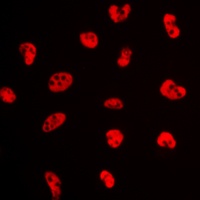 Estrogen Receptor alpha (Phospho-S106) Rabbit Polyclonal Antibody