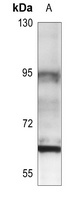 Estrogen Receptor beta Rabbit Polyclonal Antibody