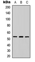 ETV4 Rabbit Polyclonal Antibody