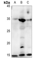 FABP4 Rabbit Polyclonal Antibody