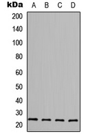 FGF6 Rabbit Polyclonal Antibody
