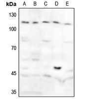 GAB1 (Phospho-Y627) Rabbit Polyclonal Antibody