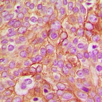 GABRB1 (Phospho-S434) Rabbit Polyclonal Antibody