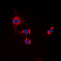 GABRB1 (Phospho-S434) Rabbit Polyclonal Antibody