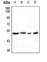 GBA3 Rabbit Polyclonal Antibody