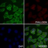 GBA3 Rabbit Polyclonal Antibody