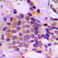 GCLM Rabbit Polyclonal Antibody