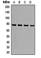 GLB1L3 Rabbit Polyclonal Antibody