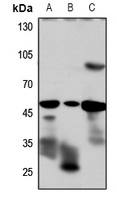 GLP-1 Receptor Rabbit Polyclonal Antibody