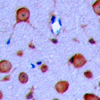 GLP-1 Receptor Rabbit Polyclonal Antibody
