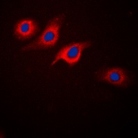 GLP-1 Receptor Rabbit Polyclonal Antibody