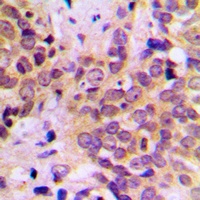 GSK3 beta Rabbit Polyclonal Antibody