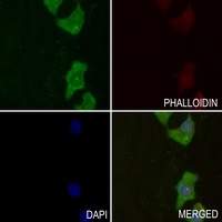 GYS1 (Phospho-S645) Rabbit Polyclonal Antibody