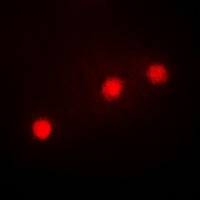 HAND1 Rabbit Polyclonal Antibody