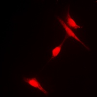 Histone Deacetylase 6 (Phospho-S22) Rabbit Polyclonal Antibody