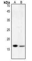 Histone H3 (Acetyl-K122) Rabbit Polyclonal Antibody