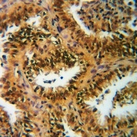 Histone H3 (Acetyl-K122) Rabbit Polyclonal Antibody
