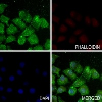 Histone H3 (Acetyl-K122) Rabbit Polyclonal Antibody