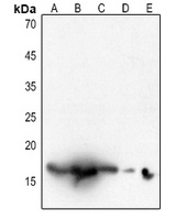 Histone H3 (Acetyl-K18) Rabbit Polyclonal Antibody
