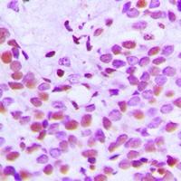 Histone H3 (Acetyl-K18) Rabbit Polyclonal Antibody