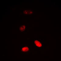Histone H3 (Acetyl-K18) Rabbit Polyclonal Antibody