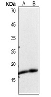 Histone H3 (Acetyl-K23) Rabbit Polyclonal Antibody
