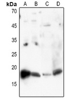 Histone H3 (Acetyl-K27) Rabbit Polyclonal Antibody