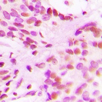 Histone H3 (Acetyl-K27) Rabbit Polyclonal Antibody