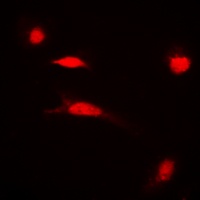 Histone H3 (Acetyl-K27) Rabbit Polyclonal Antibody