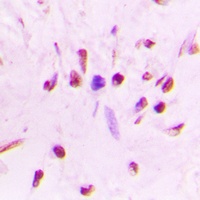 HSF1 (Phospho-S303) Rabbit Polyclonal Antibody