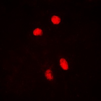 HSF1 (Phospho-S303) Rabbit Polyclonal Antibody