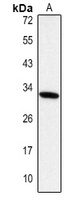 IGFBP3 Rabbit Polyclonal Antibody