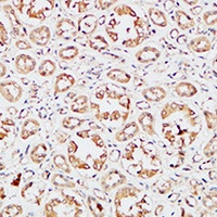 IGFBP3 Rabbit Polyclonal Antibody