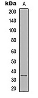 IL-12A Rabbit Polyclonal Antibody