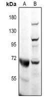 CD218b Rabbit Polyclonal Antibody