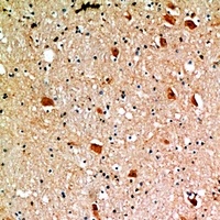 CD218b Rabbit Polyclonal Antibody
