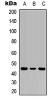 IL-1R2 Rabbit Polyclonal Antibody