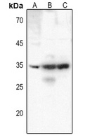 CD25 Rabbit Polyclonal Antibody