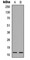 IL-1F5 Rabbit Polyclonal Antibody