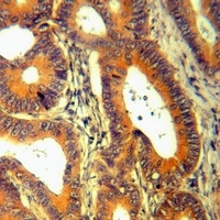 IL-1F5 Rabbit Polyclonal Antibody