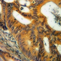 CD124 Rabbit Polyclonal Antibody